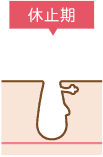 休止期